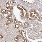 Immunohistochemical staining of human kidney shows strong cytoplasmic positivity in cells in tubules.