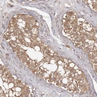 Immunohistochemical staining of human testis shows strong cytoplasmic positivity in cells in seminiferous ducts.