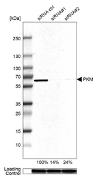 Western blot analysis in A-549 cells transfected with control siRNA, target specific siRNA probe #1 and #2, using Anti-PKM antibody. Remaining relative intensity is presented. Loading control: Anti-GAPDH.
