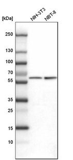 Anti-PKM Antibody