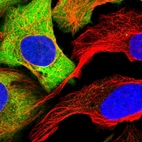 Immunofluorescent staining of human cell line U-2 OS shows localization to cytosol.