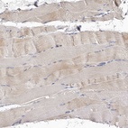 Immunohistochemical staining of human skeletal muscle shows low expression as expected.