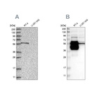 Anti-BAIAP2L1 Antibody