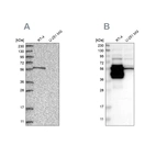 Western blot analysis using Anti-BAIAP2L1 antibody HPA029503 (A) shows similar pattern to independent antibody HPA019484 (B).
