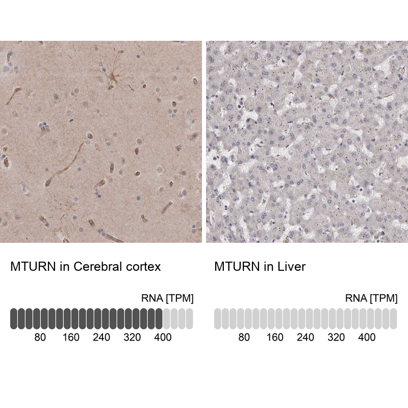 Anti-MTURN Antibody