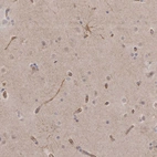 Immunohistochemical staining of human cerebral cortex shows moderate cytoplasmic positivity in glial cells.