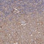 Immunohistochemical staining of human cerebellum shows strong positivity in neuronal processes in cells in molecular layer.