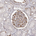 Immunohistochemical staining of human kidney shows strong cytoplasmic positivity in cells in glomeruli.