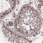 Immunohistochemical staining of human testis shows strong cytoplasmic positivity in cells in seminiferous ducts.