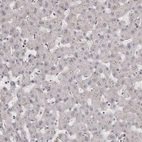 Immunohistochemical staining of human liver shows no cytoplasmic positivity in hepatocytes as expected.