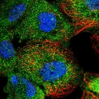Immunofluorescent staining of human cell line A-431 shows localization to cytosol.