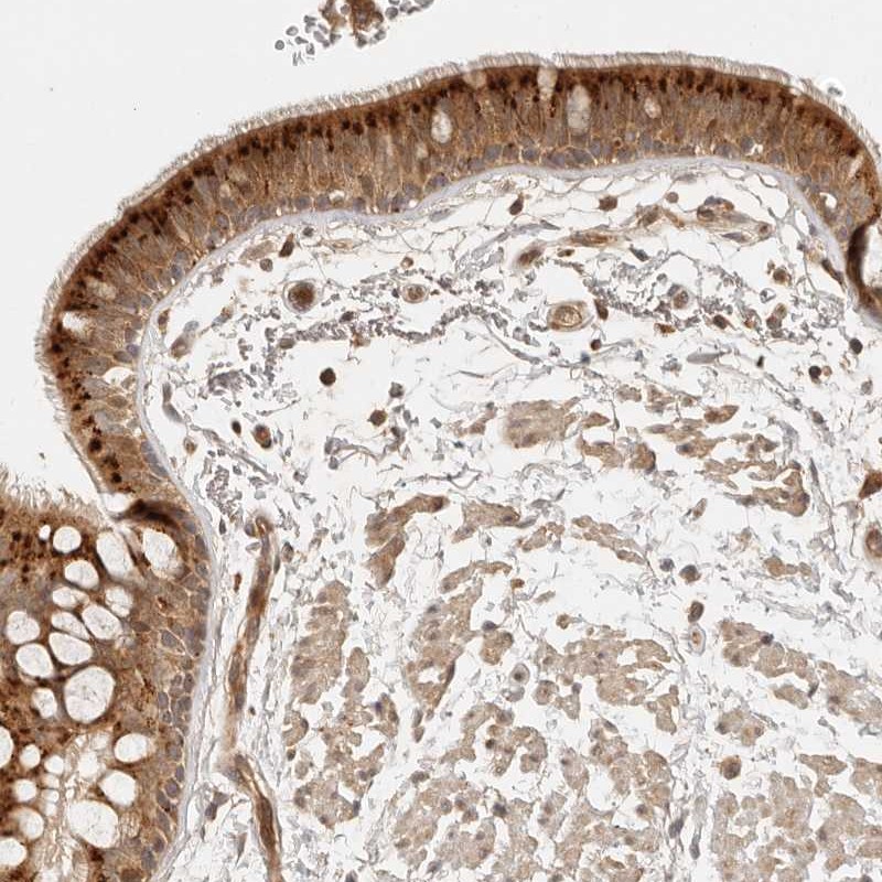 Anti-ANKRD61 Antibody