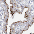 Anti-PSPH Antibody