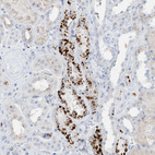 Immunohistochemical staining of human kidney shows strong granular cytoplasmic positivity in cells in distal tubules.