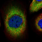 Immunofluorescent staining of human cell line A-431 shows localization to cytosol.