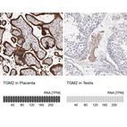 Anti-TGM2 Antibody