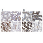 Immunohistochemical staining of human endometrium, fallopian tube, placenta and testis using Anti-TGM2 antibody HPA029518 (A) shows similar protein distribution across tissues to independent antibody HPA021019 (B).