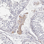 Immunohistochemical staining of human testis shows weak cytoplasmic positivity in Leydig cells.