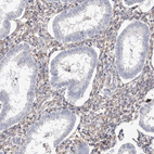 Immunohistochemical staining of human endometrium shows moderate cytoplasmic positivity in stromal cells.