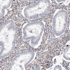 Immunohistochemical staining of human endometrium shows moderate cytoplasmic positivity in stromal cells.