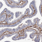 Immunohistochemical staining of human Fallopian tube shows moderate cytoplasmic positivity in stromal cells.