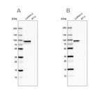 Western blot analysis using Anti-TGM2 antibody HPA029518 (A) shows similar pattern to independent antibody HPA021019 (B).