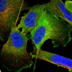 Immunofluorescent staining of human cell line U-251 MG shows localization to plasma membrane & cytosol.