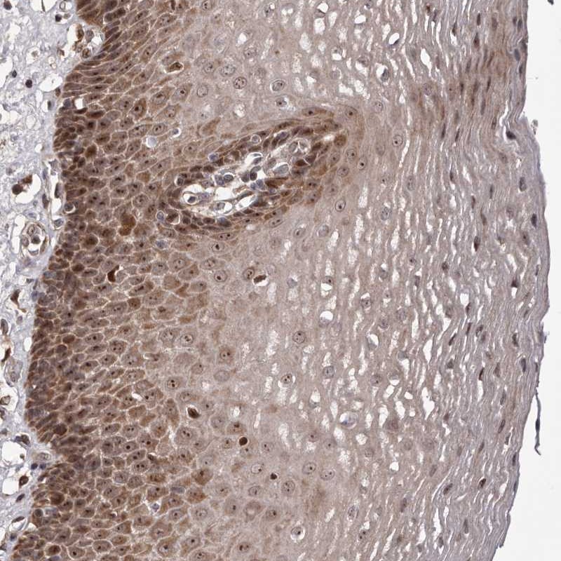 Anti-ZCCHC7 Antibody