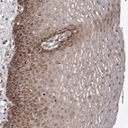 Anti-ZCCHC7 Antibody