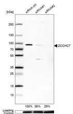 Anti-ZCCHC7 Antibody