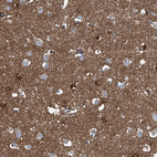 Immunohistochemical staining of human cerebral cortex shows strong cytoplasmic positivity in neuropil.
