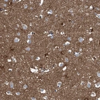 Immunohistochemical staining of human cerebral cortex shows strong cytoplasmic positivity in neuropil.