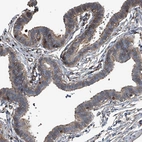 Immunohistochemical staining of human fallopian tube shows strong cytoplasmic positivity in glandular cells.