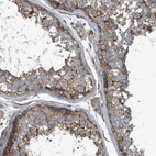 Immunohistochemical staining of human testis shows moderate positivity in cells in seminiferous ducts.