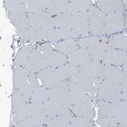 Immunohistochemical staining of human skeletal muscle shows no positivity in myocytes as expected.