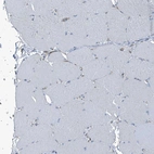 Immunohistochemical staining of human skeletal muscle shows no positivity in myocytes as expected.