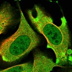 Immunofluorescent staining of human cell line U-2 OS shows localization to nucleoplasm & cytosol.