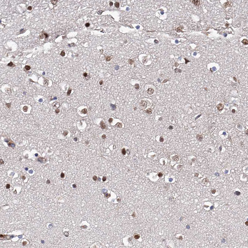 Anti-ZNF655 Antibody