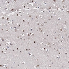 Anti-ZNF655 Antibody