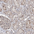 Immunohistochemical staining of human kidney shows moderate nuclear positivity in cells in tubules.