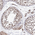Immunohistochemical staining of human testis shows strong nuclear positivity in cells in seminiferous ducts.