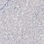 Immunohistochemical staining of human liver shows no positivity in hepatocytes as expected.
