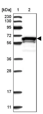 Lane 1: Marker [kDa] 230, 130, 95, 72, 56, 36, 28, 17, 11_br/_Lane 2: Human cell line RT-4