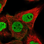 Immunofluorescent staining of human cell line A-431 shows localization to nucleoplasm & plasma membrane.