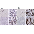 Immunohistochemical staining of human cerebral cortex, colon, liver and rectum using Anti-SATB2 antibody HPA029543 (A) shows similar protein distribution across tissues to independent antibody HPA001042 (B).