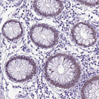 Anti-SATB2 Antibody