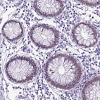 Immunohistochemical staining of human colon shows strong nuclear positivity in glandular cells.