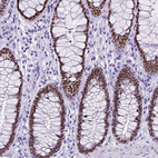 Immunohistochemical staining of human rectum shows strong nuclear positivity in glandular cells.