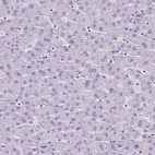 Immunohistochemical staining of human liver shows no positivity in hepatocytes as expected.