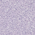 Immunohistochemical staining of human liver shows no positivity in hepatocytes as expected.